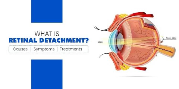 What is Retinal Detachment (Detached Retina)? Causes, Symptoms, and Treatment Options