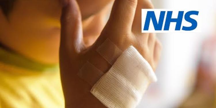 How do I deal with burns and scalds? (9 to 30 months) | NHS