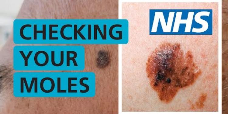 How do I check if my mole is skin cancer? | NHS