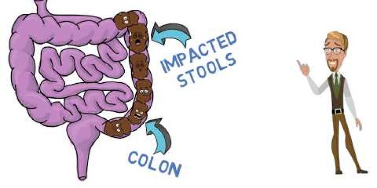 The effective treatment of childhood constipation according to NICE guidelines.