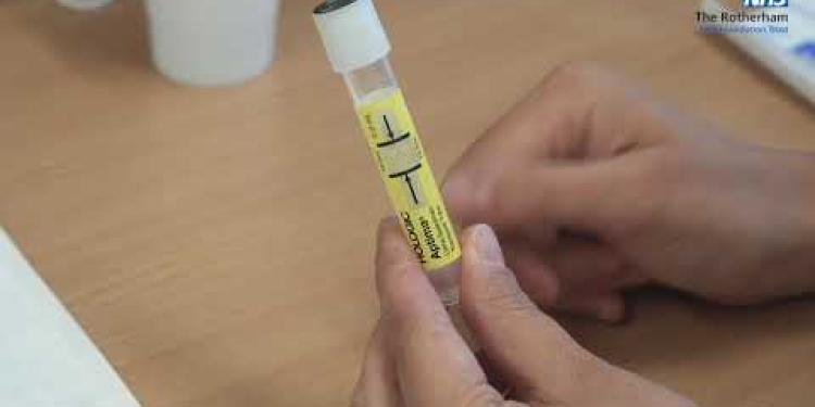 Urine test for Gonorrhoea and Chlamydia