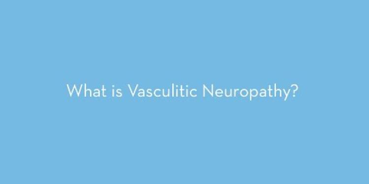 What is vasculitic neuropathy?