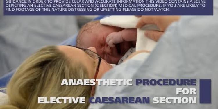 Anaesthetic procedure for elective caesarean section (C section)