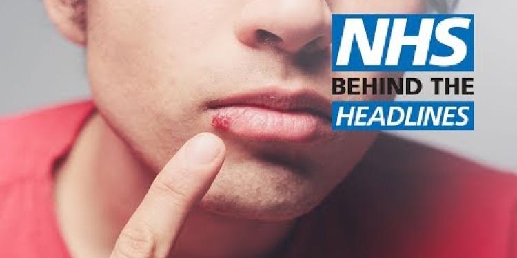 Honey 'as good as antiviral creams' for cold sores | NHS Behind the Headlines