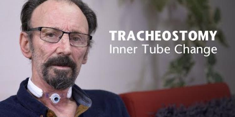 NHSGGC - Care of Tracheostomy: Inner Tube Change