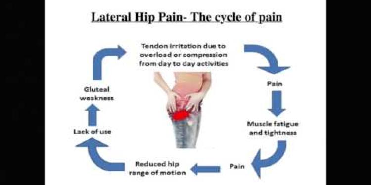 Advice -  How to manage your lateral hip pain