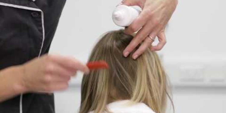 Treating scalp psoriasis
