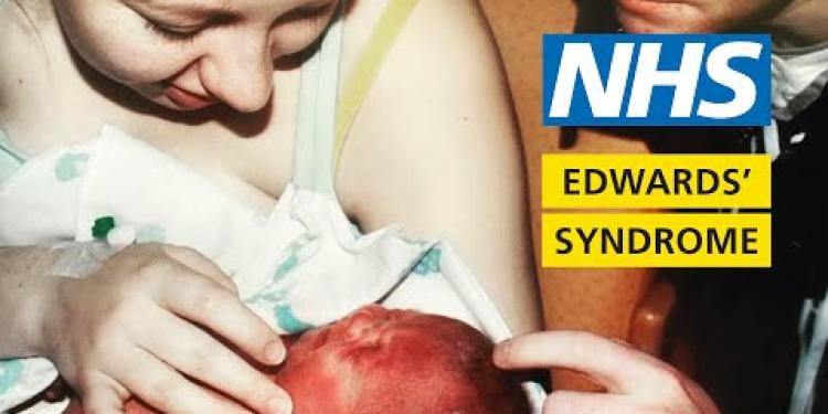 What it's like to have a baby with Edwards' syndrome - My Story - Chloe and Penelope | NHS